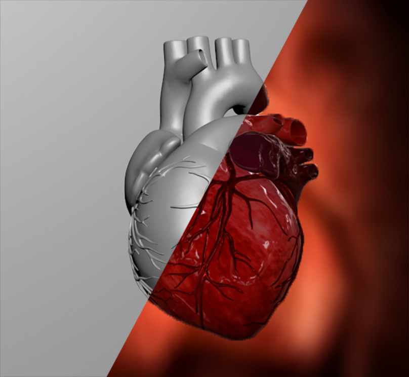 Khatai Zeynalli - 3D heart model