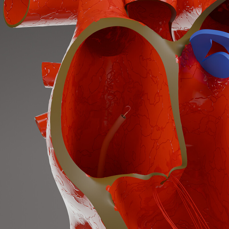 NorthStar Medical Work