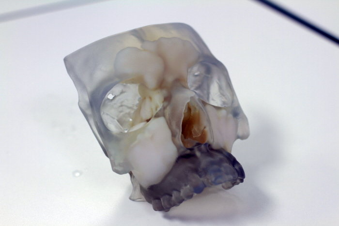 A 3D printed model visualizing the location of the different sinus'  I prepared the model for printing from CT data in zbrush