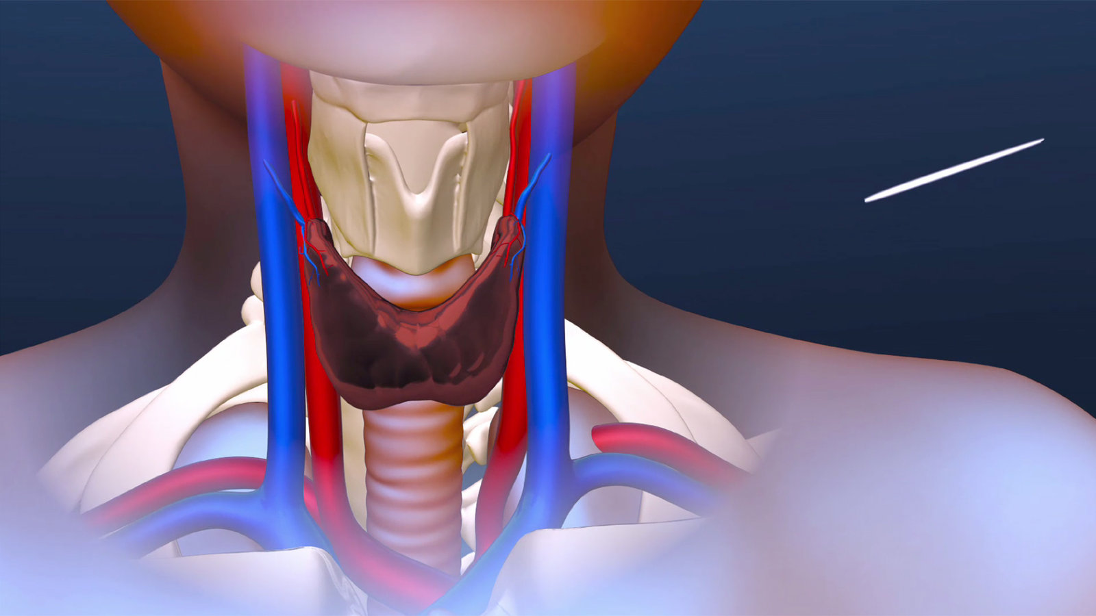 Still from an animation I created showing a new surgical technique