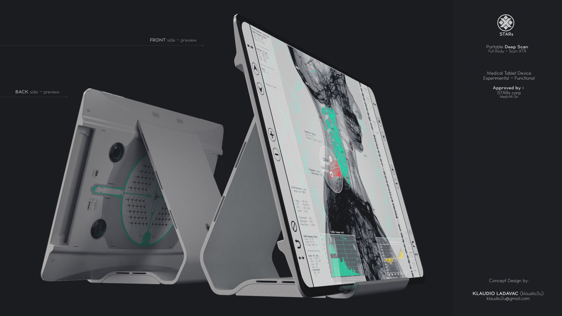 klaudio ladavac full body scan xtr