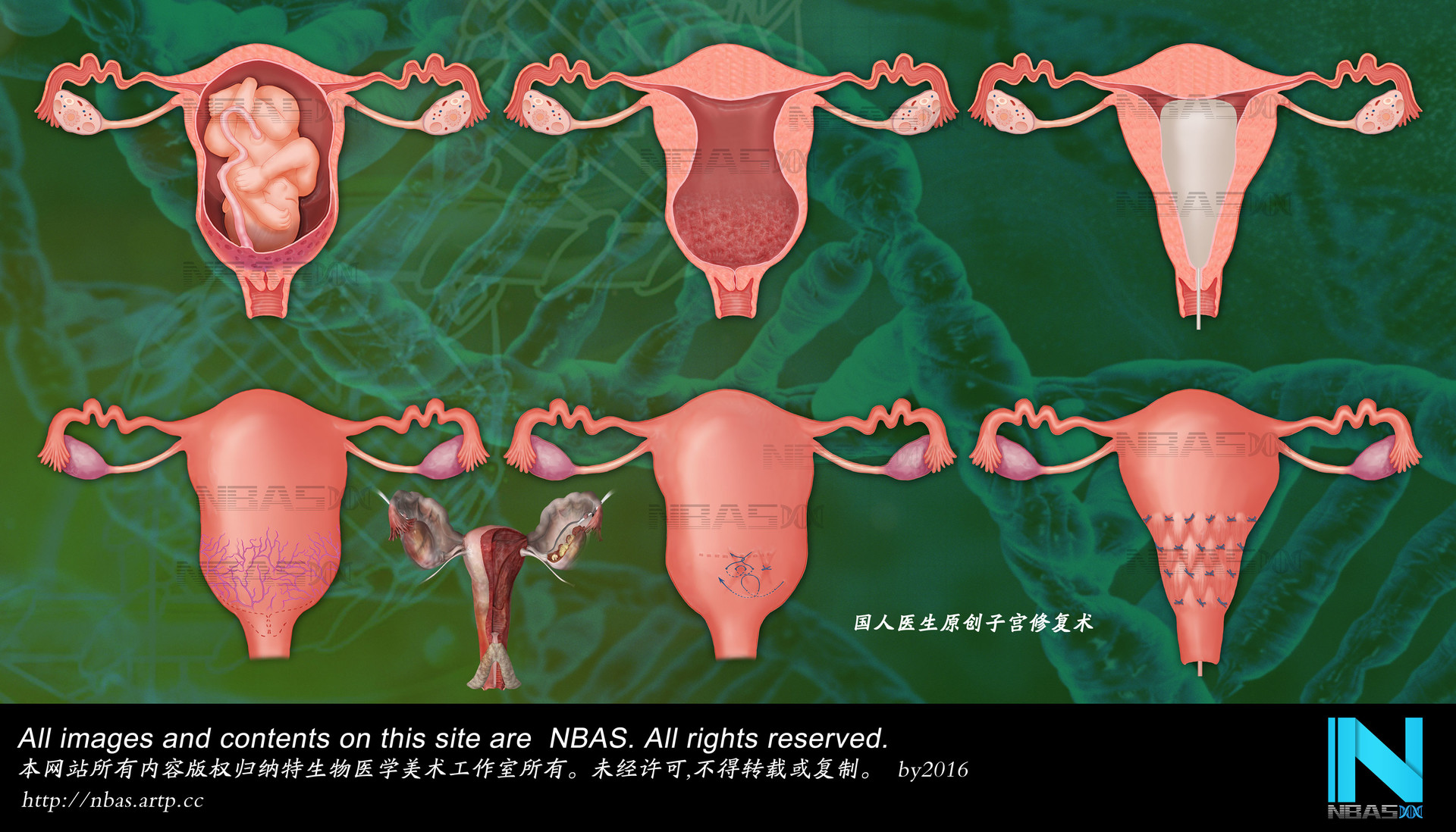 Fa Guan Medical Arts Medical Illustration Medical Animation In