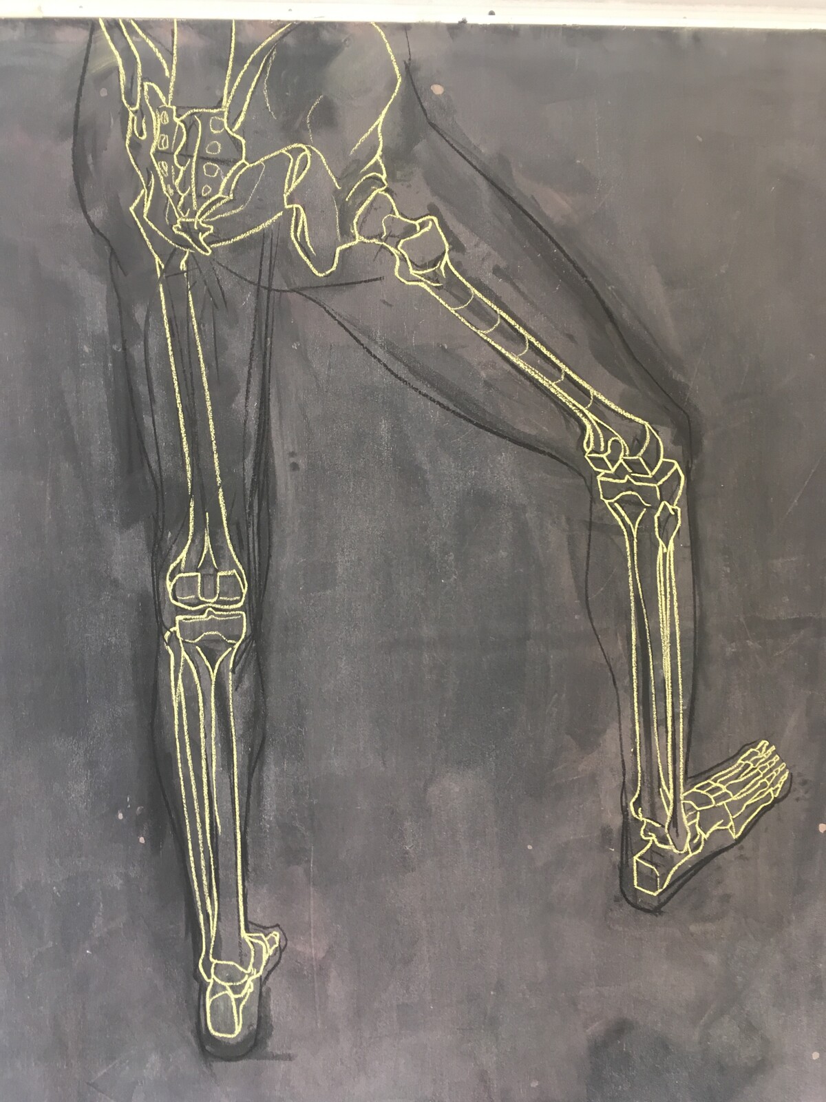 Ostéologie du membre inférieur - os iliaque, fémur, tibia, fibula, calcaneum, talus,  tarses, phalanges