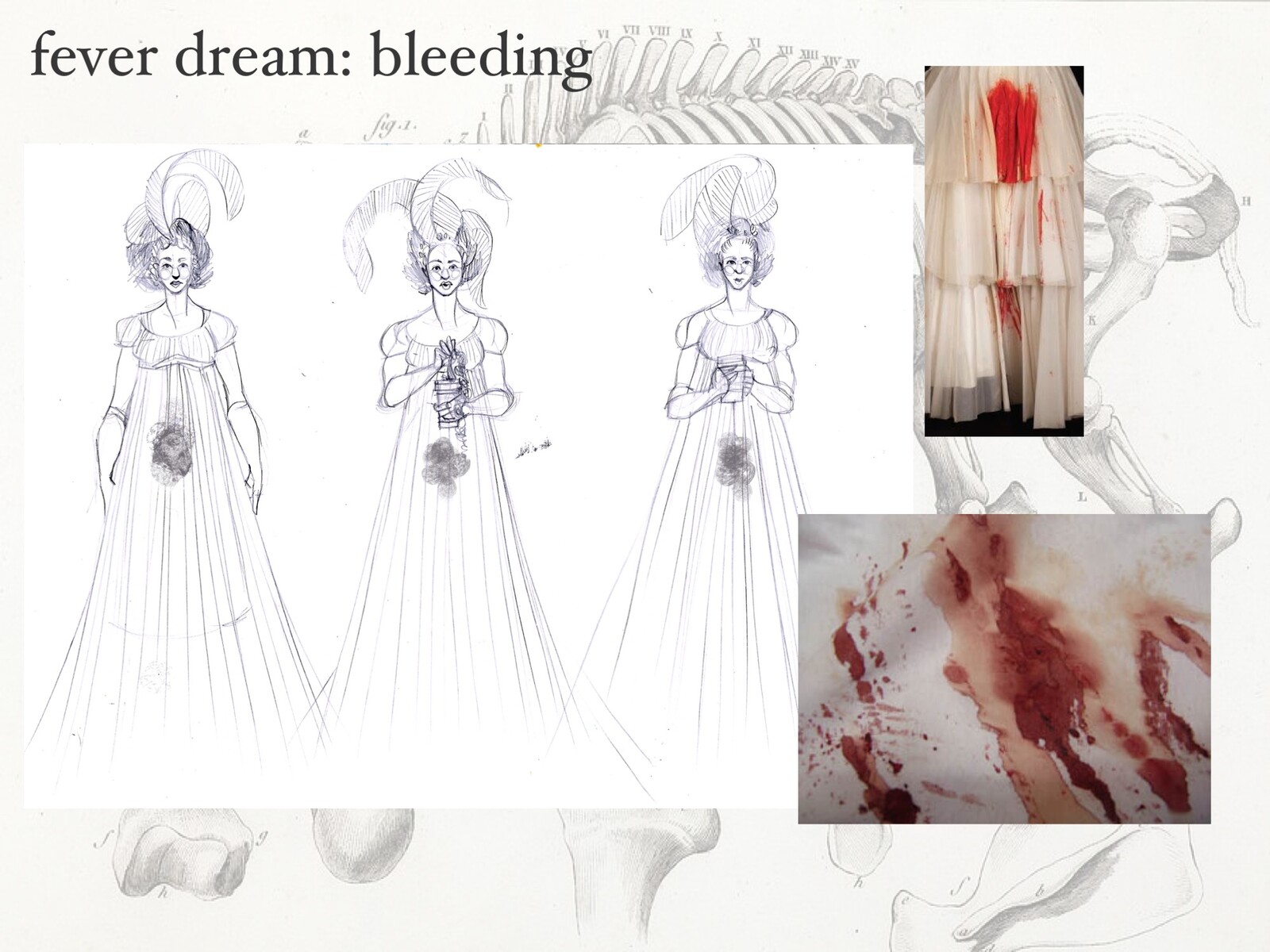 These dresses bled; some distressing references are above.
