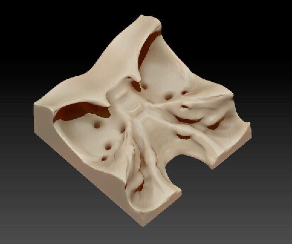 3D Model of the Cranial Base