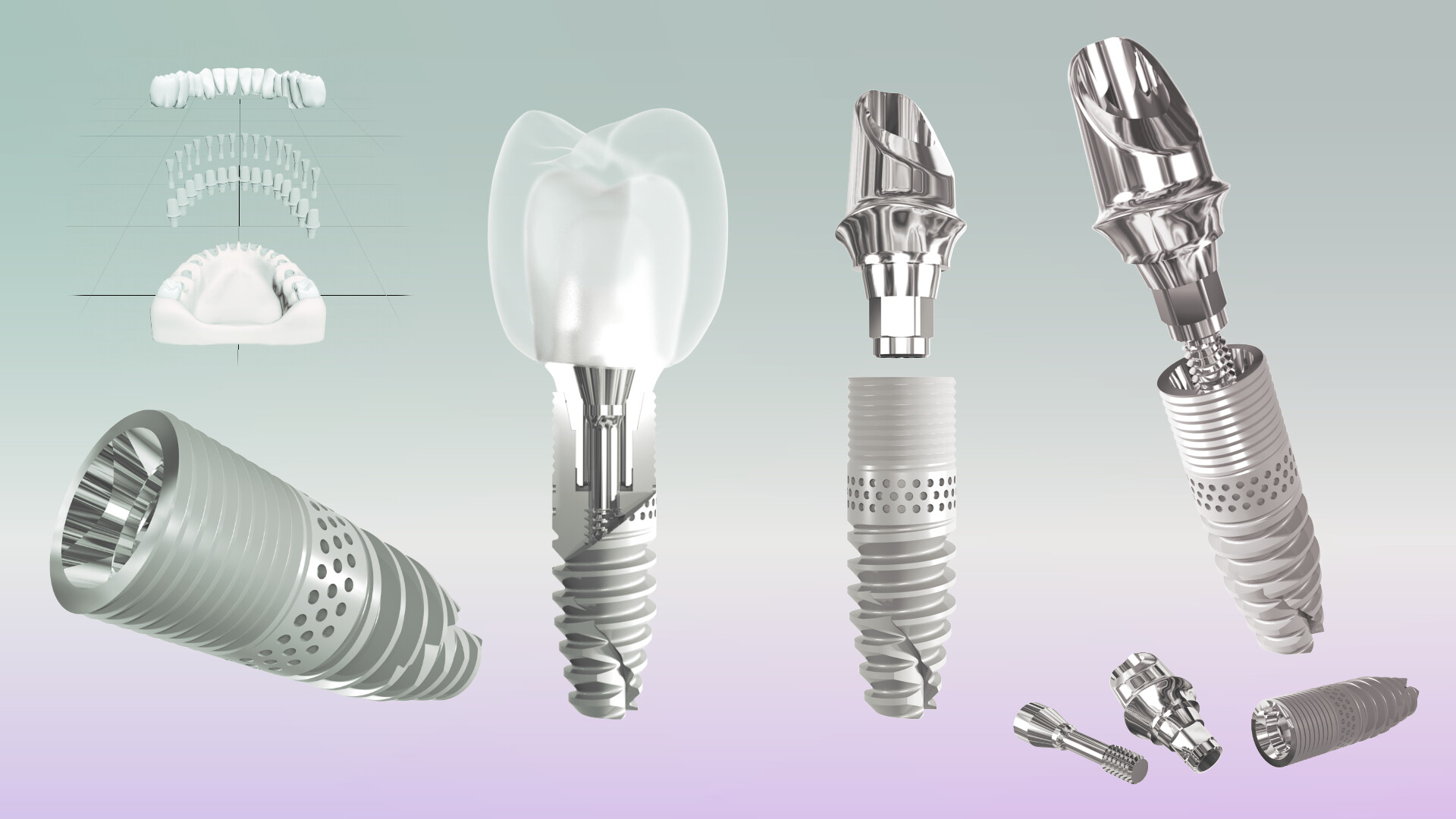 ArtStation - Dental Implants