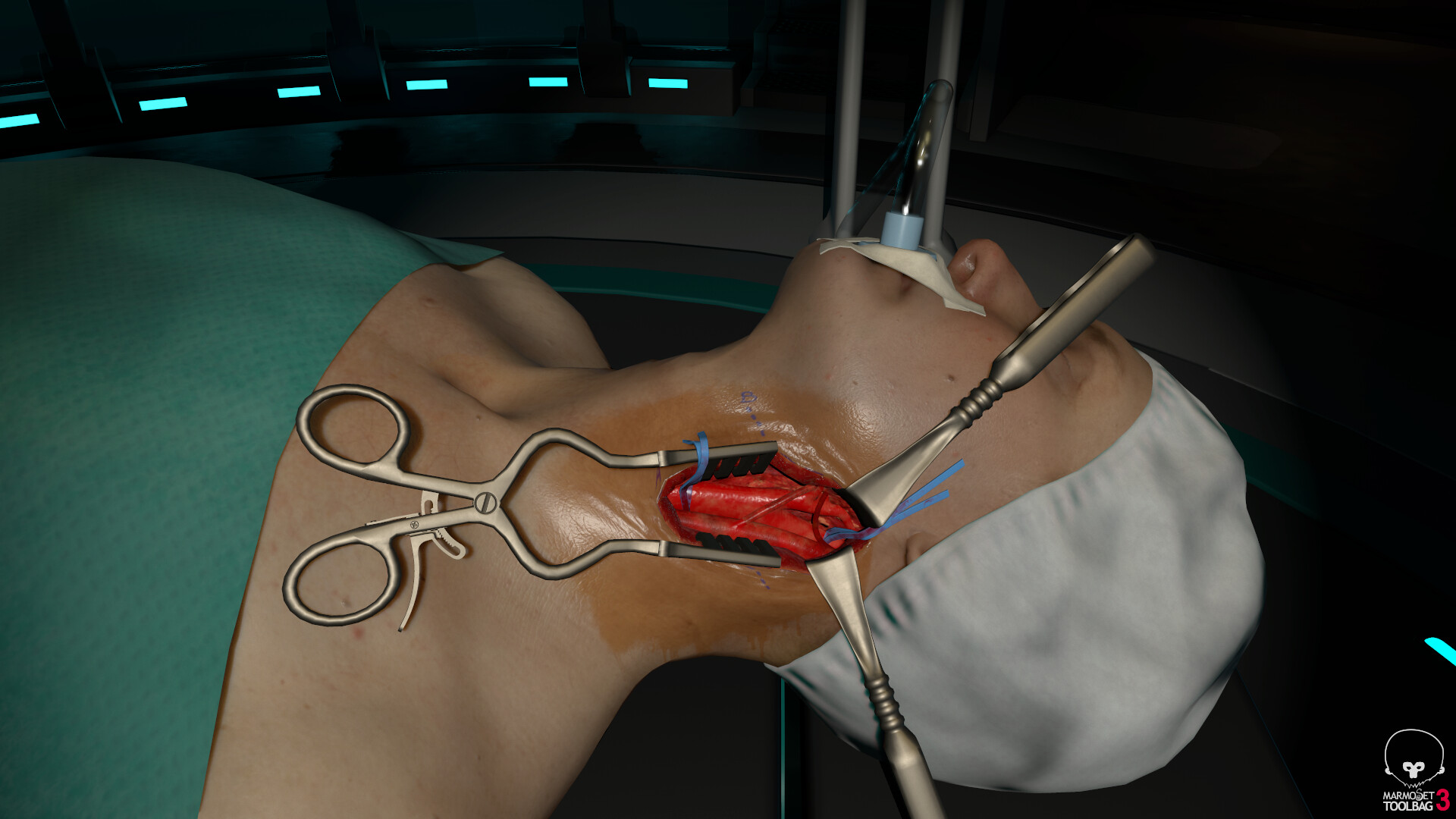 Artstation Carotid Endarterectomy Vr And Force Feedback