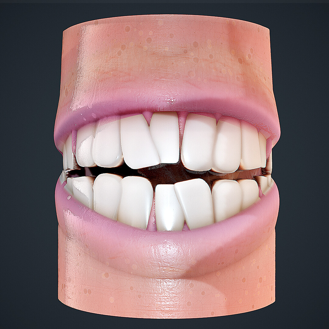 animated crooked teeth