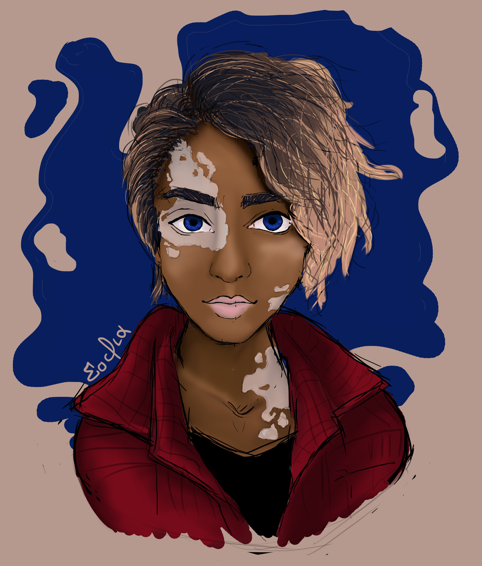 18+ How To Draw Vitiligo AnnekaNevada