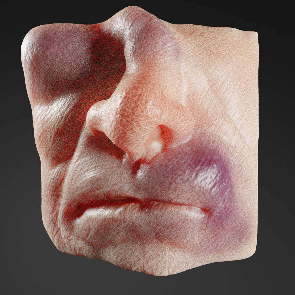 What Does A Broken Nose Look Like lupon.gov.ph