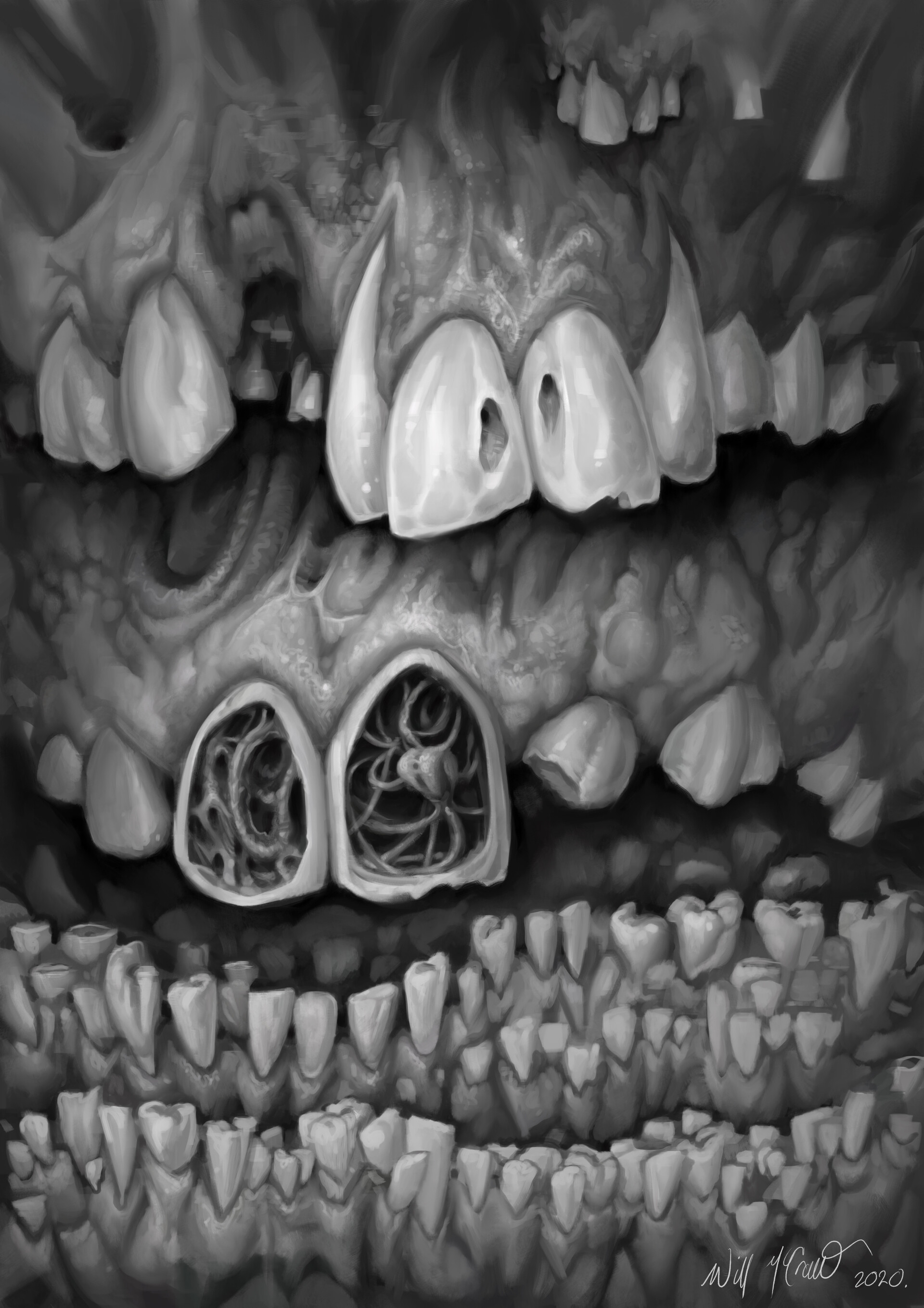 ArtStation Tooth Decay