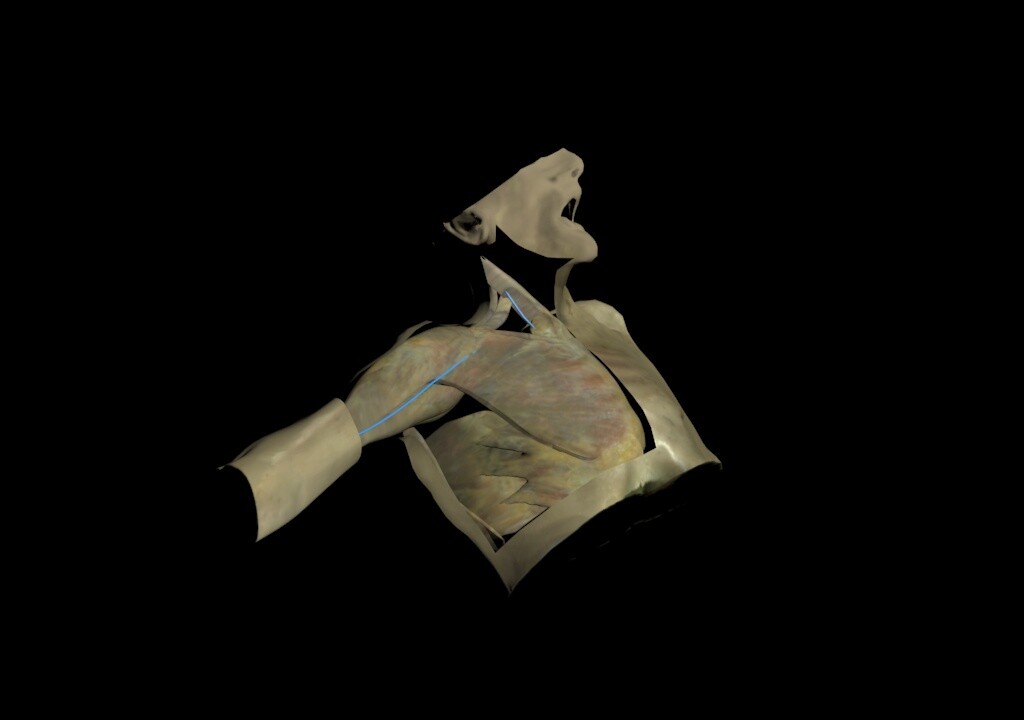 Clément Sipion - Corpse (model for Medecine)