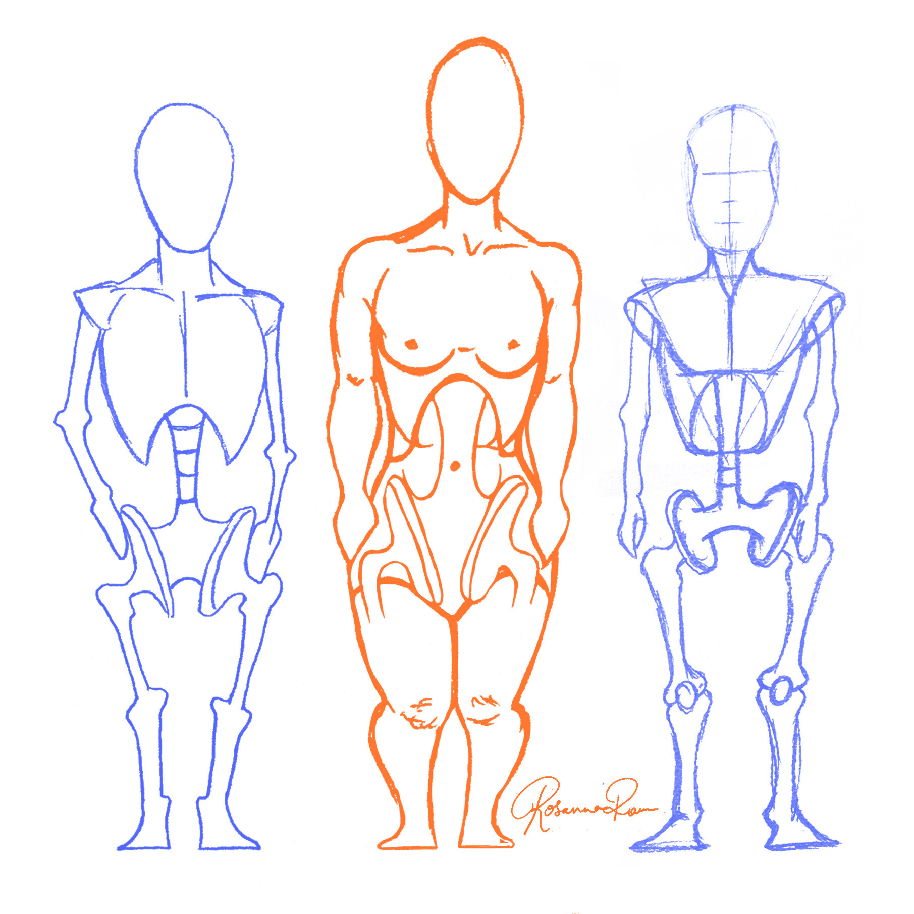 Artstation Dwarfism Anatomy Rosanna Rann