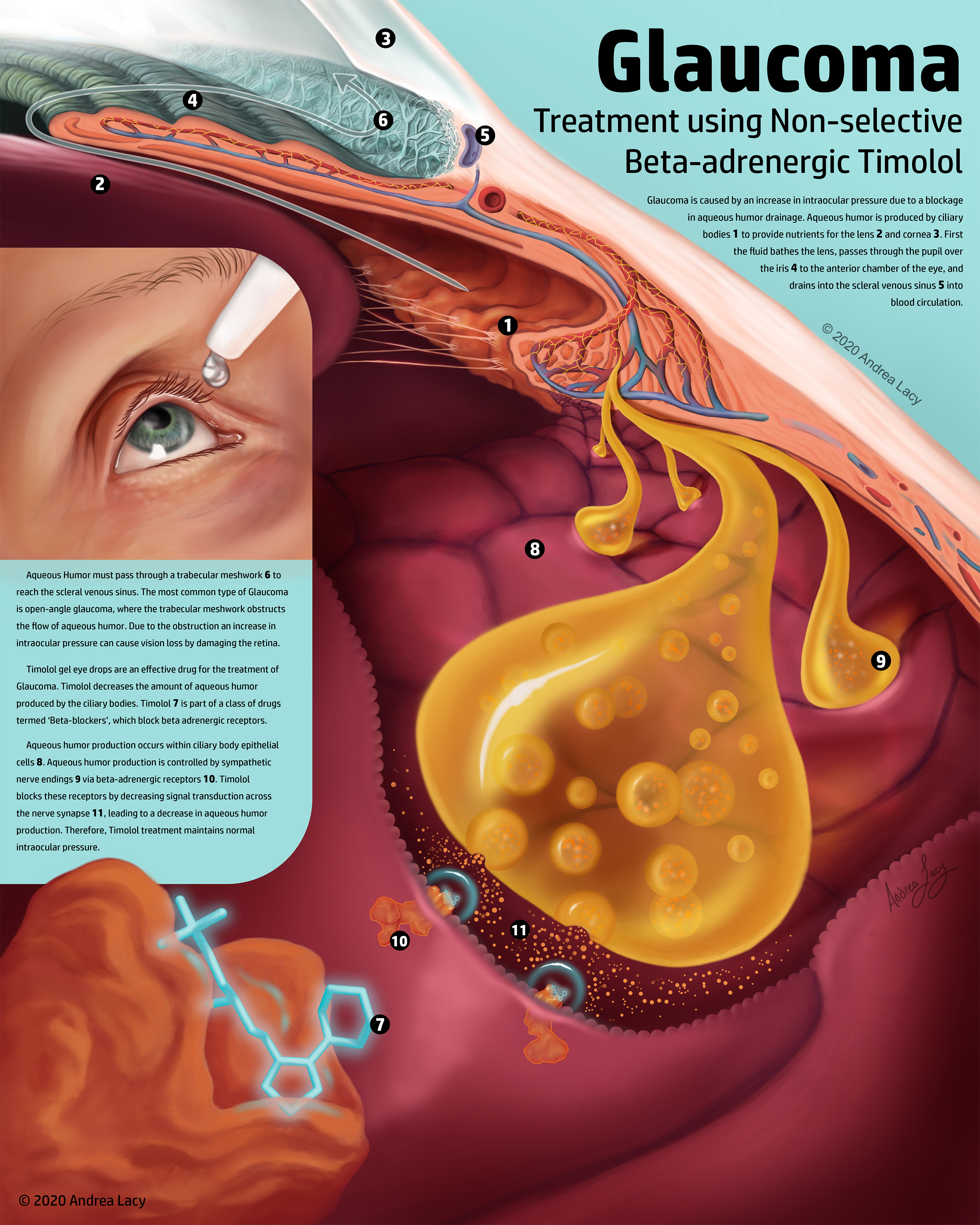Andrea Lacy biomedical illustration Treatment Poster