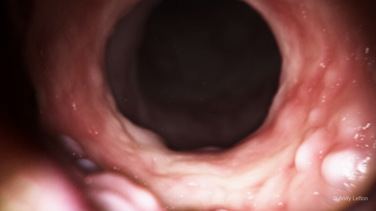 3D Colon by Andy Lefton