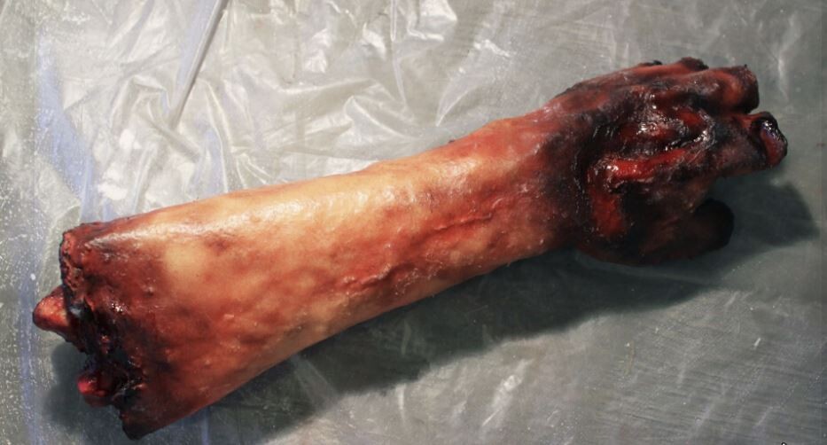 Charred arm