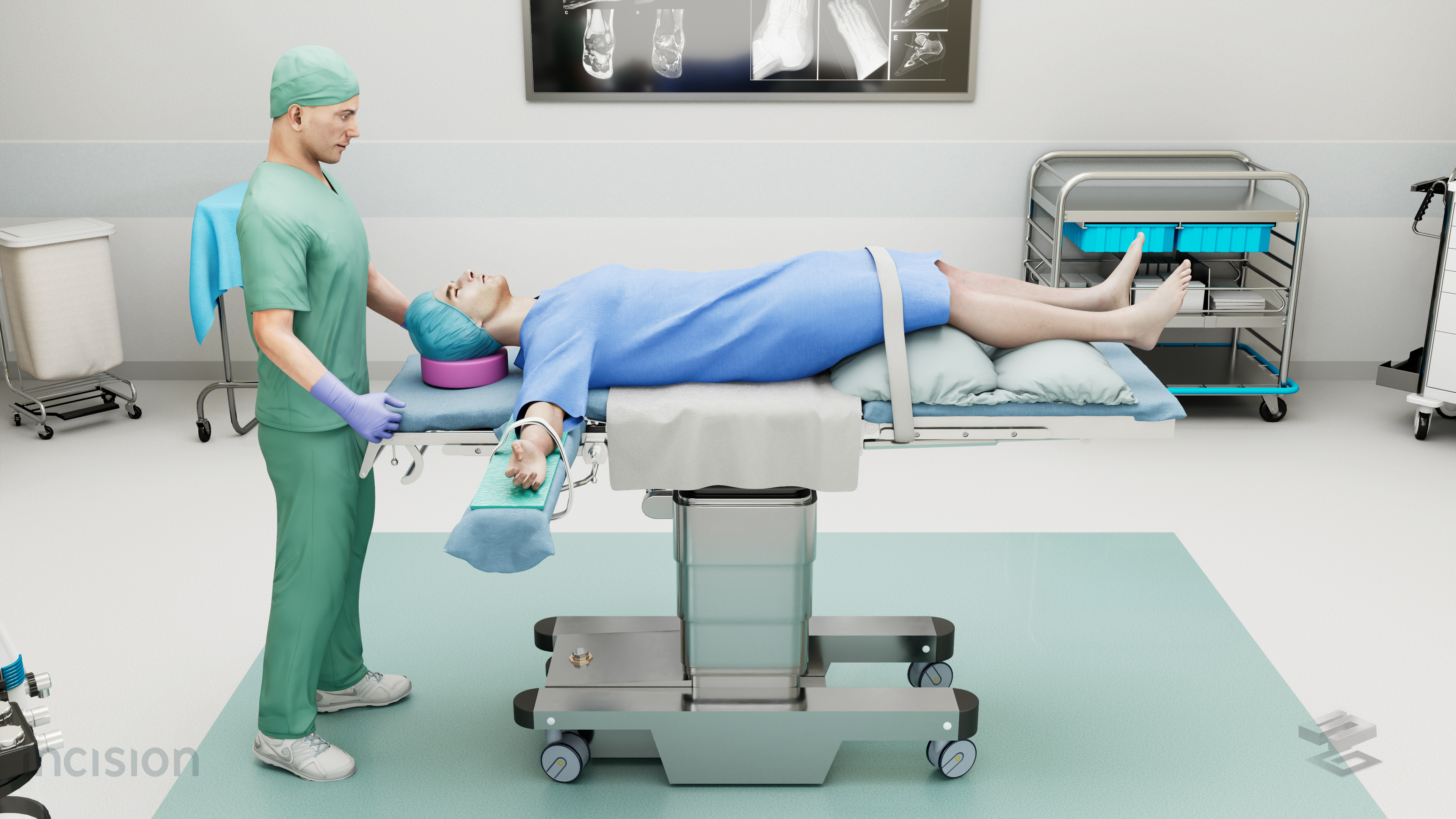 Final Comp - side view of Supine patient positioning