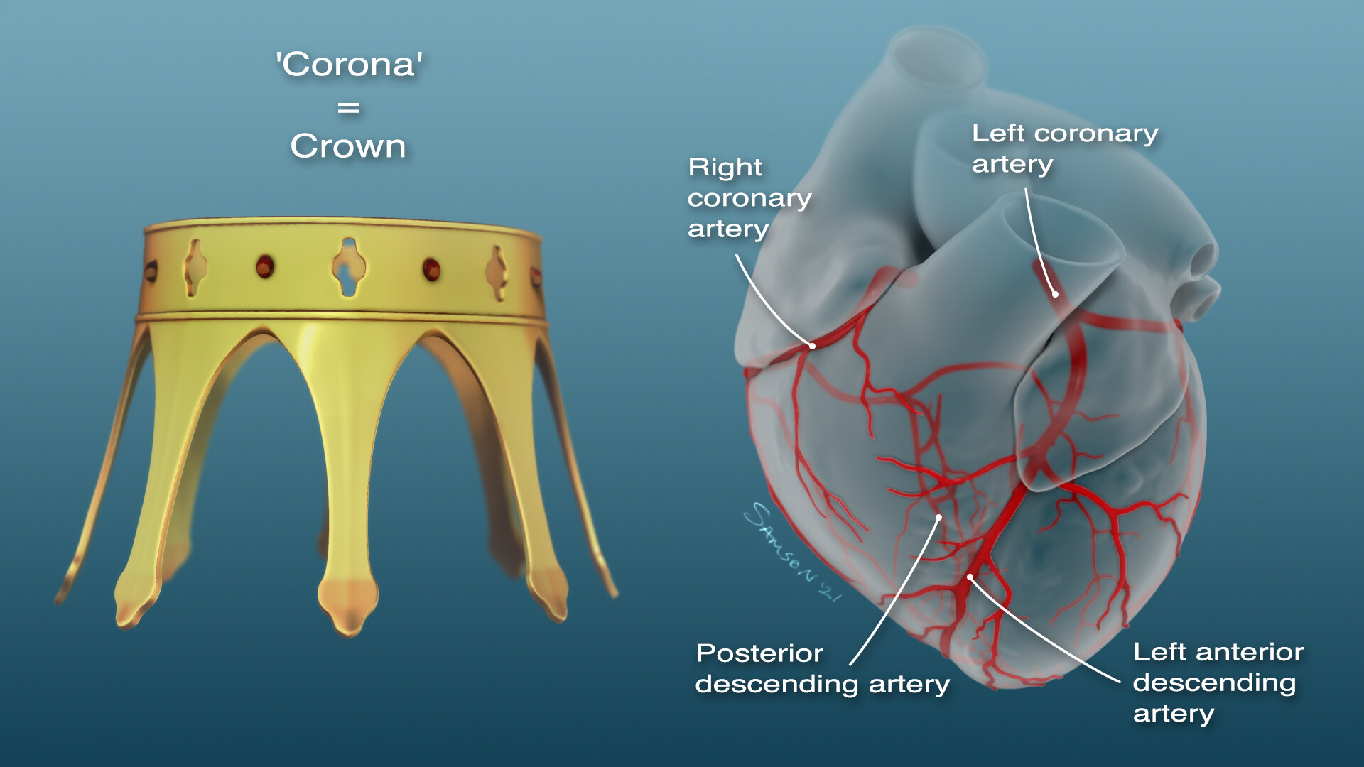 Joe Samson Coronary Artery Illustrations