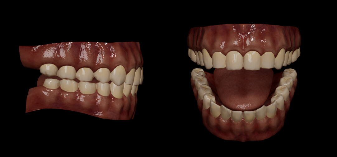A special image just for his teeth since it's not really shown in any other image