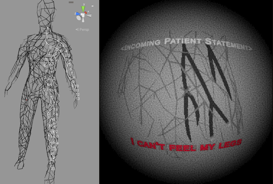Variant 1 : The spline system supports splitting off into different branches for levels where the player navigates the human body in 3rd person