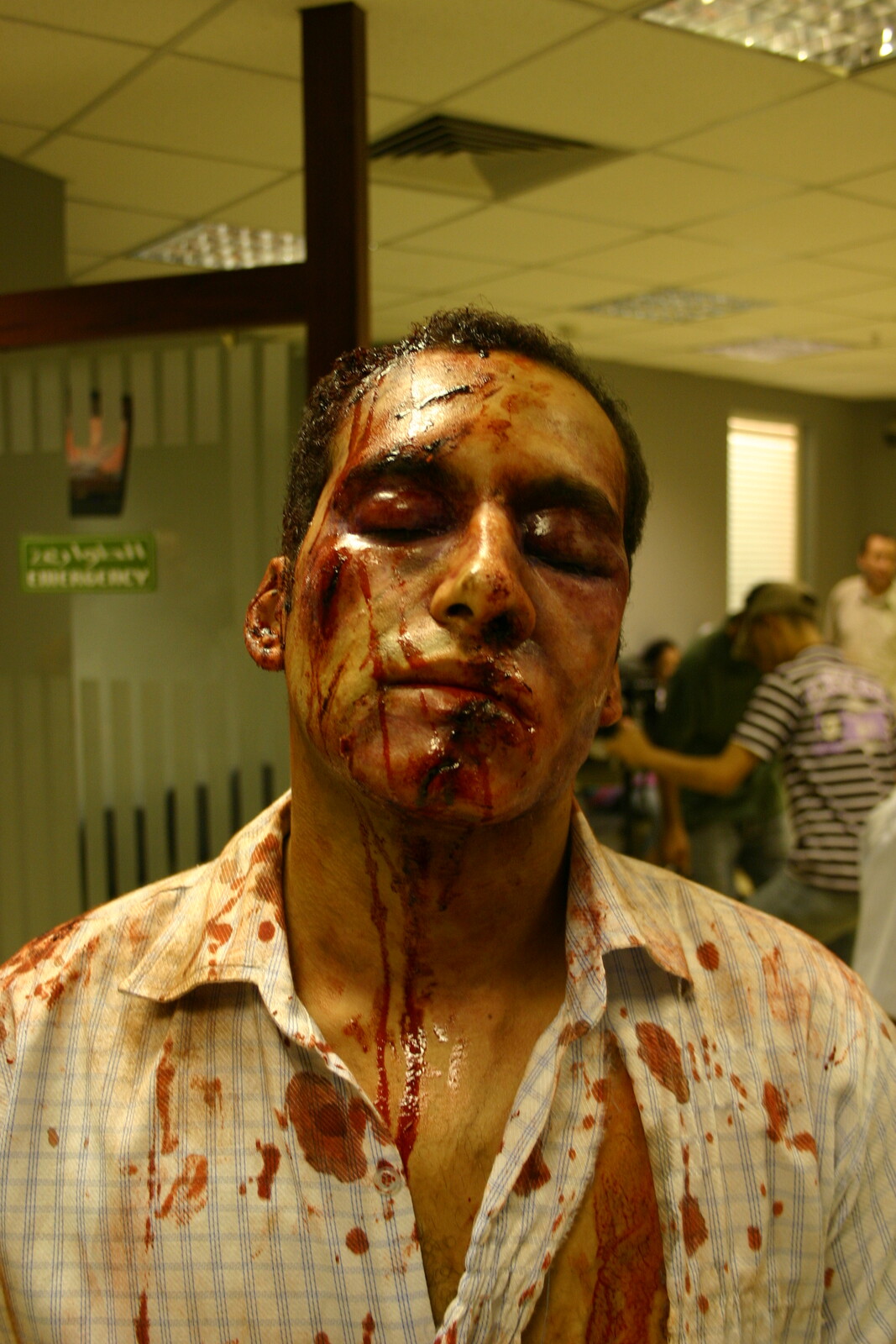Beating Injury Makeup