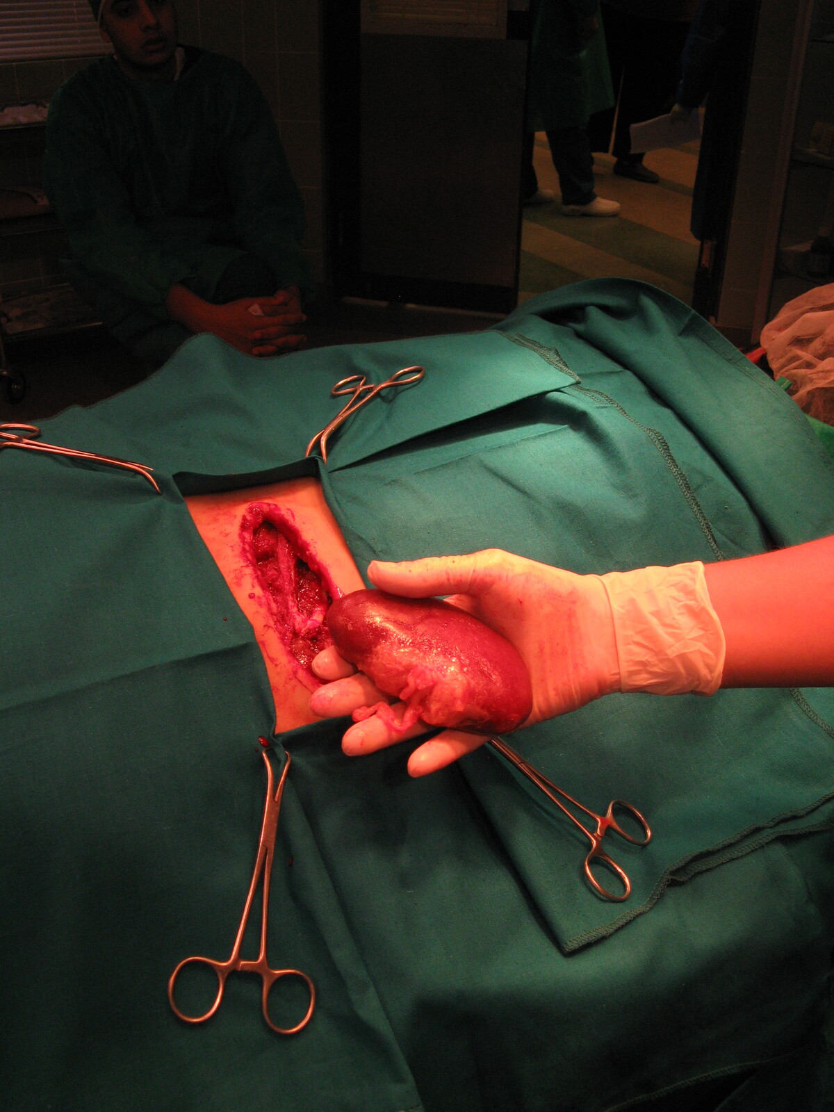 CRITICAL MOMENTS Kidney surgery setup