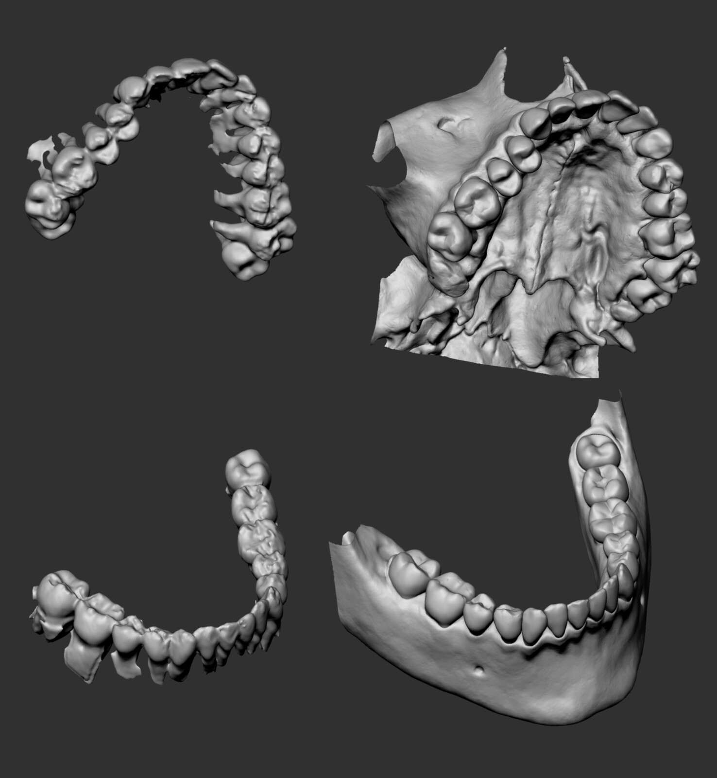 The teeth were the most tedious part - it was difficult to cleanly separate the touching top and bottom teeth in Slicer so I had to re-sculpt the surfaces.