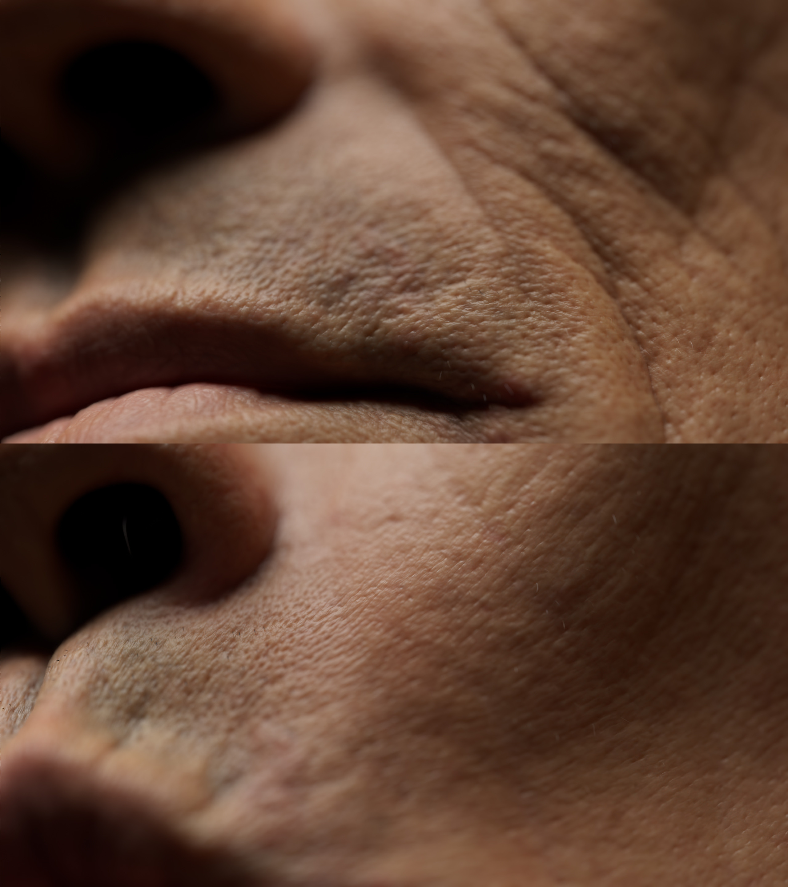 Per pore deformation