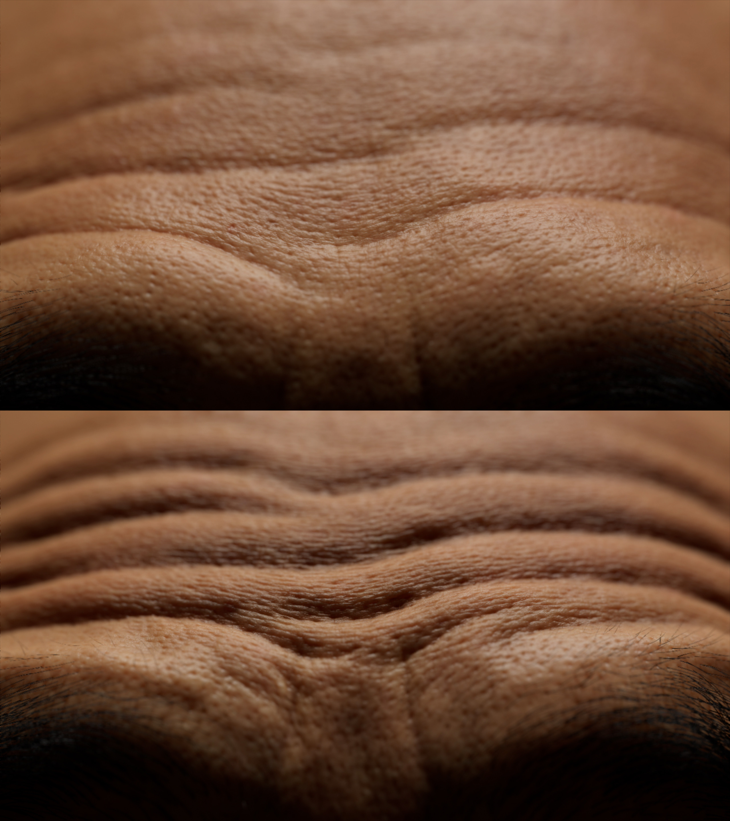 Per pore deformation