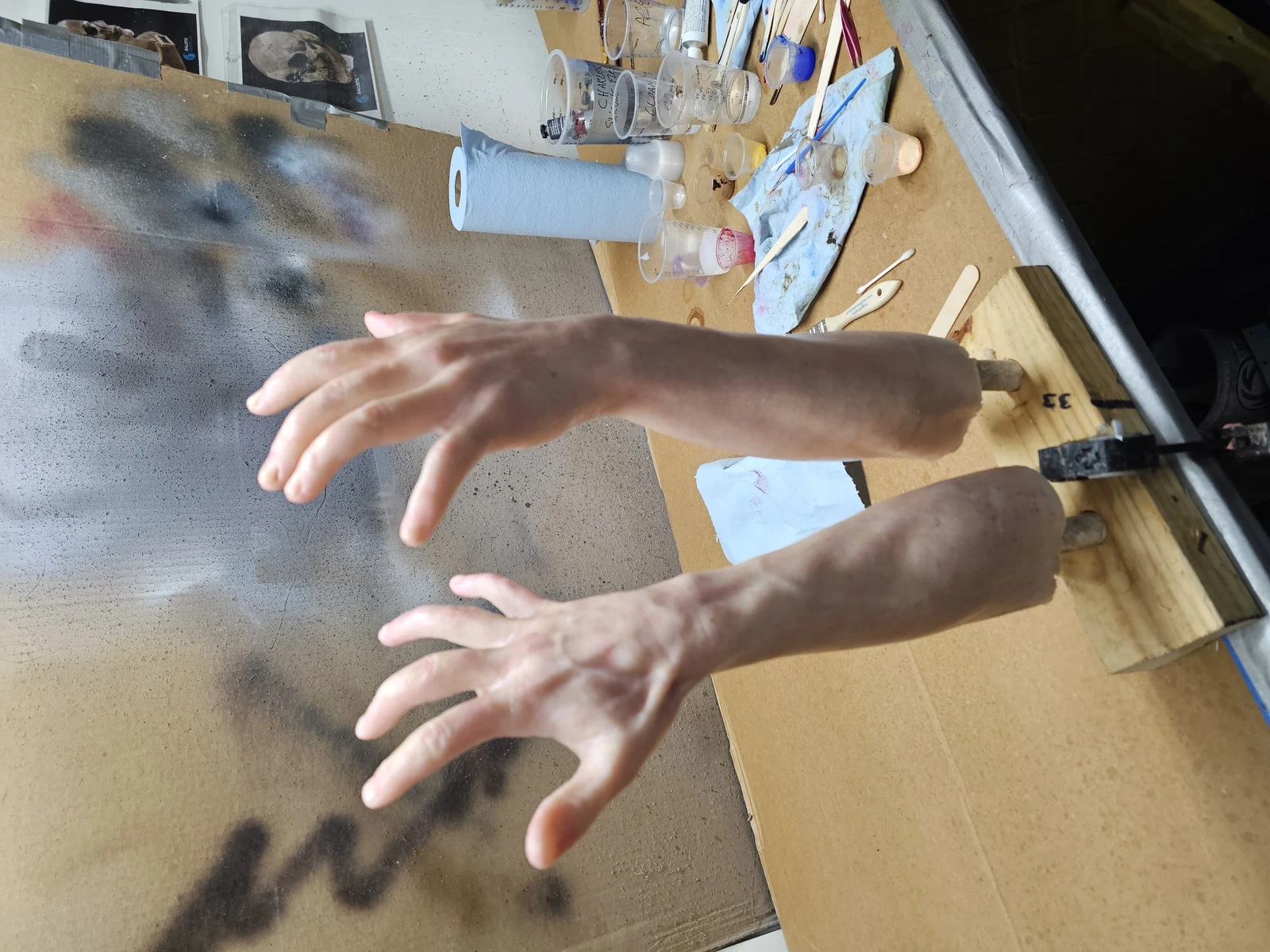 Prosthetic Arms