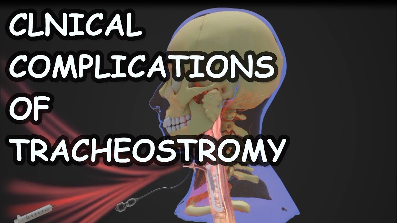 ArtStation - Clinical complications of tracheostomy || 3D CGI Animation ||  Medical Animation