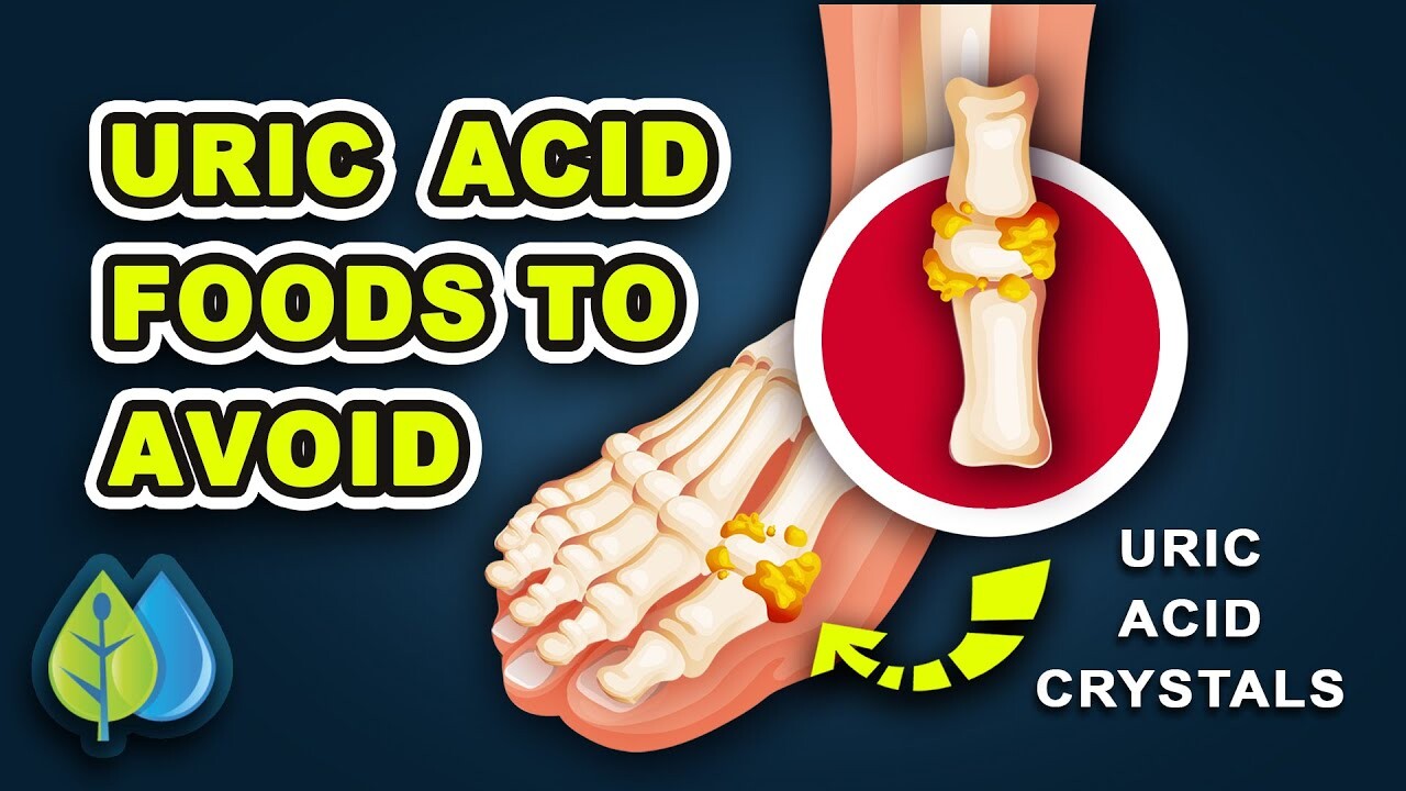 ArtStation - Top 10 Uric Acid Foods to Avoid (WORST for Gout)