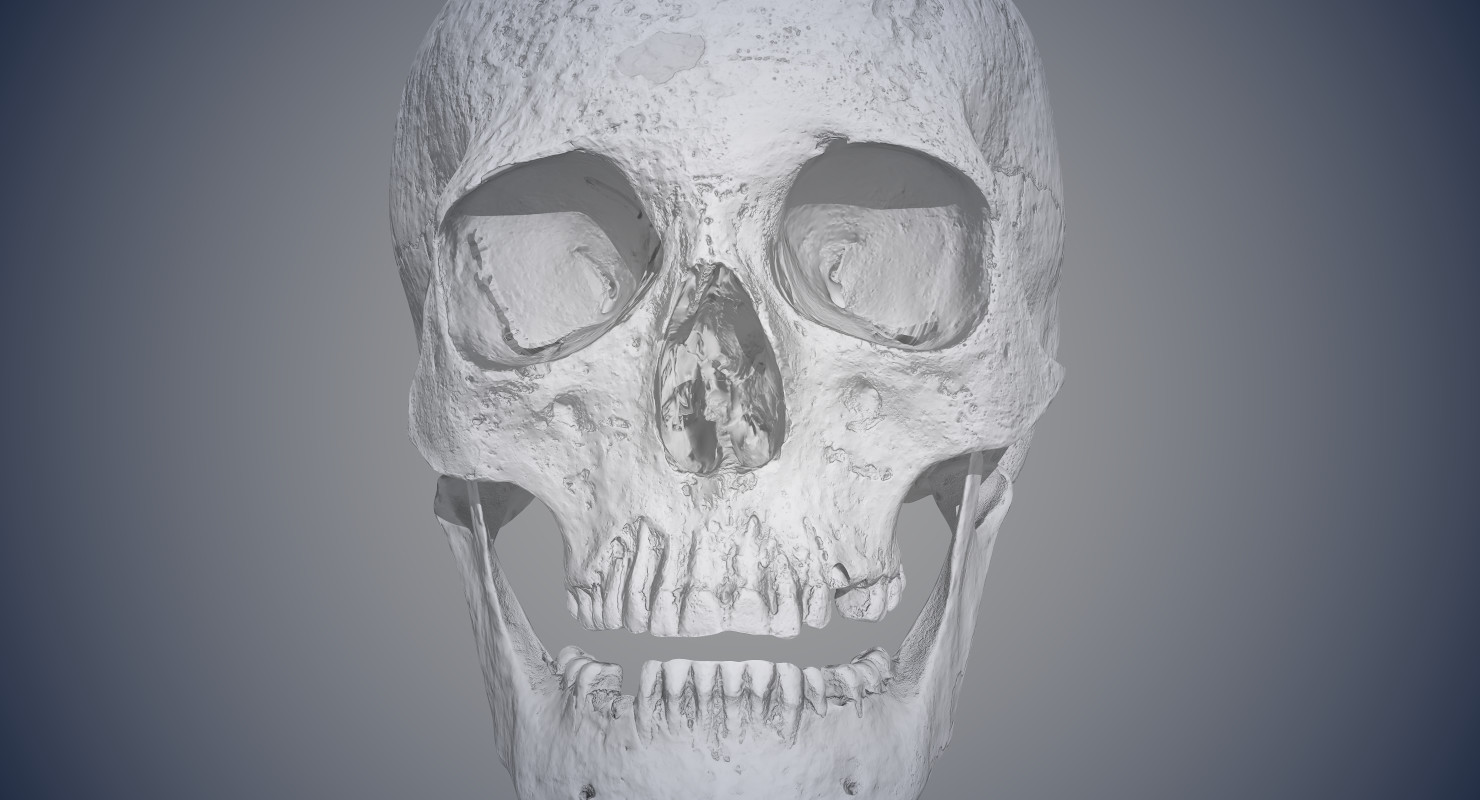 Skull 18