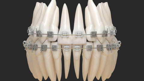 Teeth 3D Print and Render.