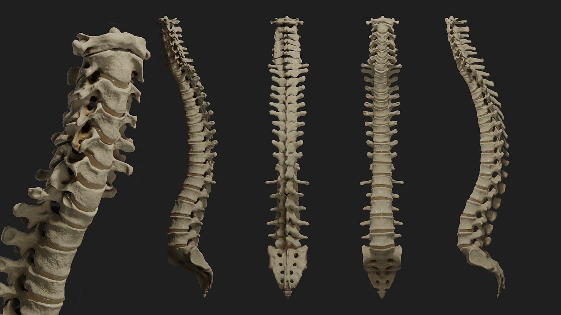 Lumbar Spine 3d