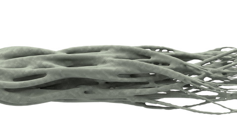 Osteoporosis