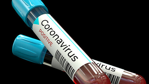 Blood Test Tube Coronavirus Covid 19 3D Model