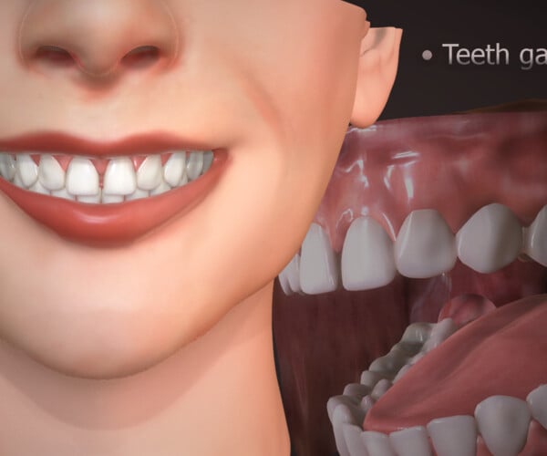 monster teeth texture