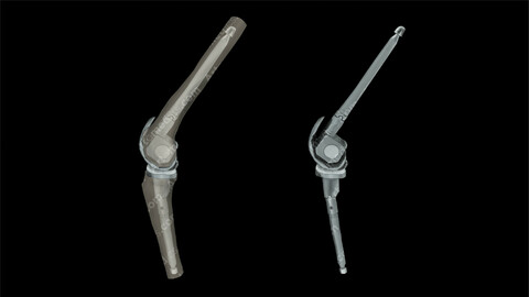 Knee Prosthesis Link Lateral (Lateral)