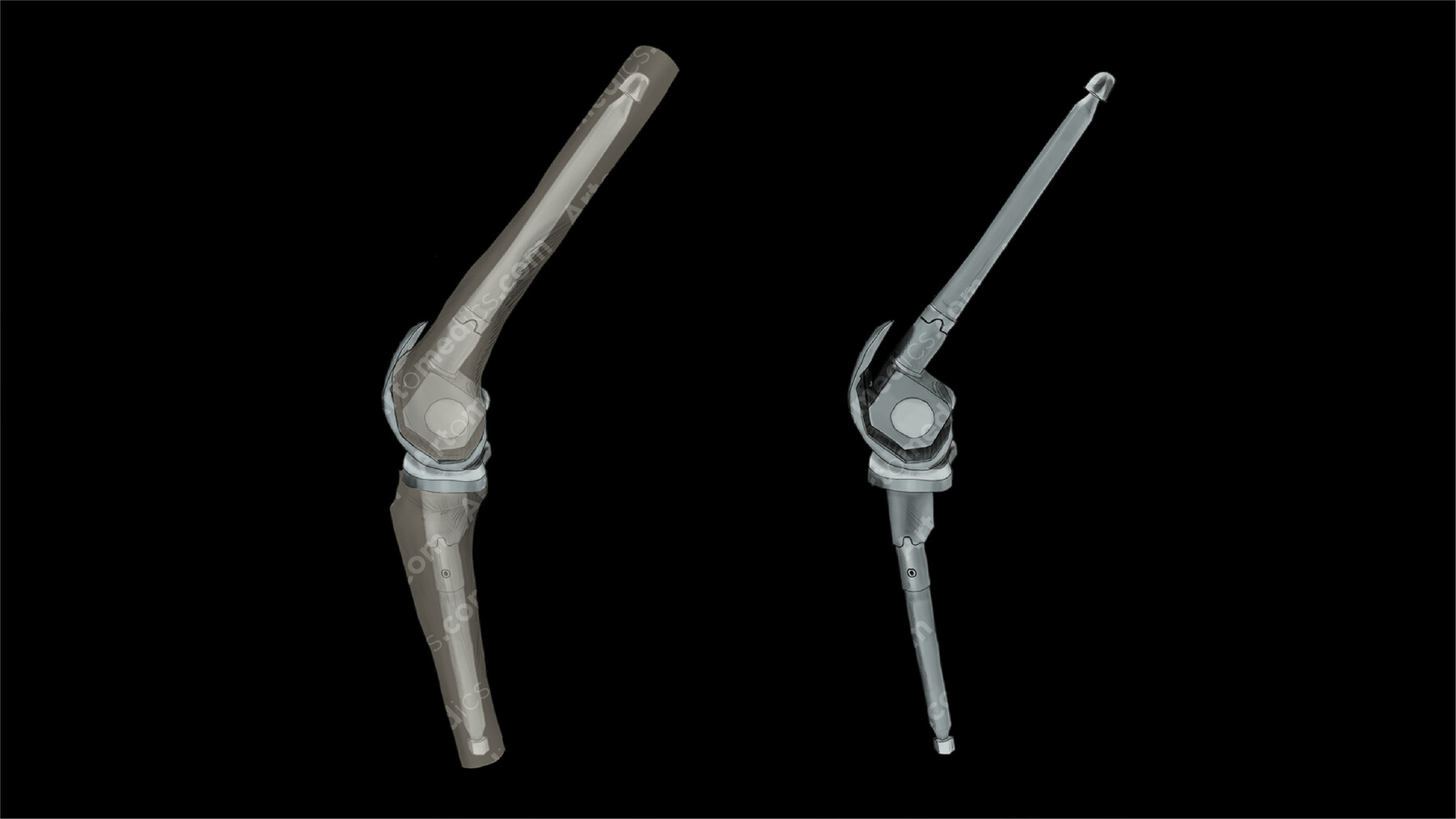 ArtStation Knee Prosthesis Link Lateral (Lateral) Artworks