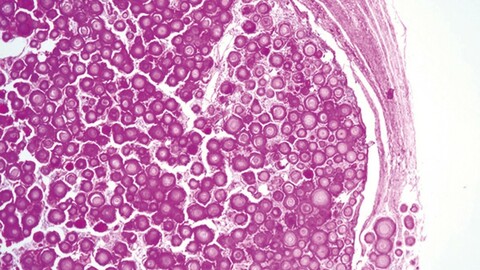 Collection of Histological studies of various types of cancer diseases