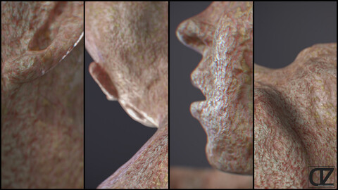 PBR - INFECTED SKIN - 4K MATERIAL